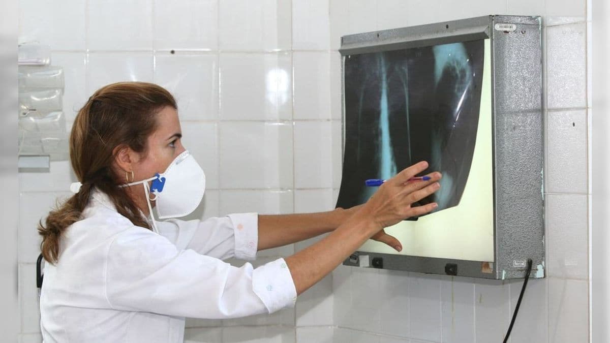 Tuberculose ainda é um sério problema de saúde pública no Brasil