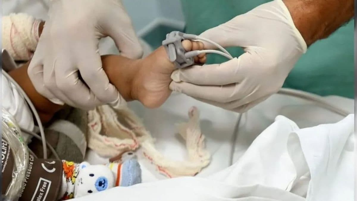 São cinco de uso para internação de criança e doze para adultos