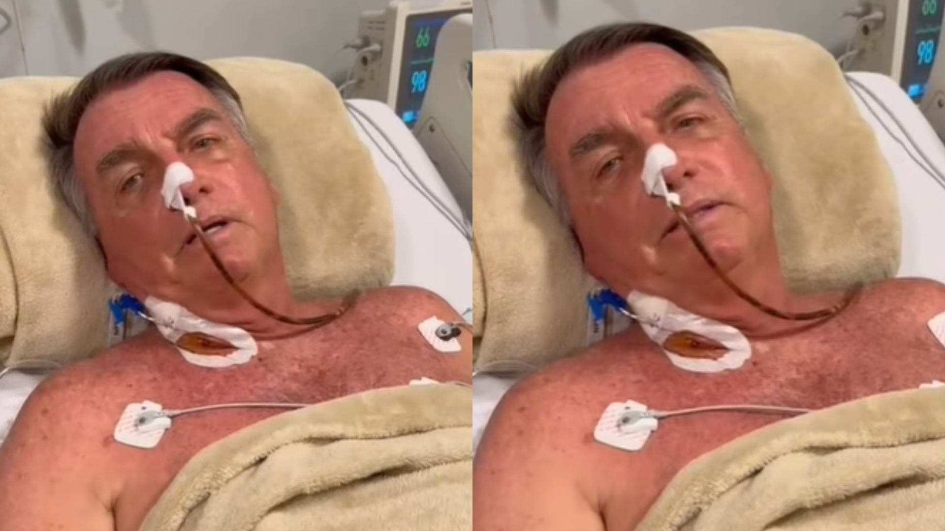 Bolsonaro segue internado no RN