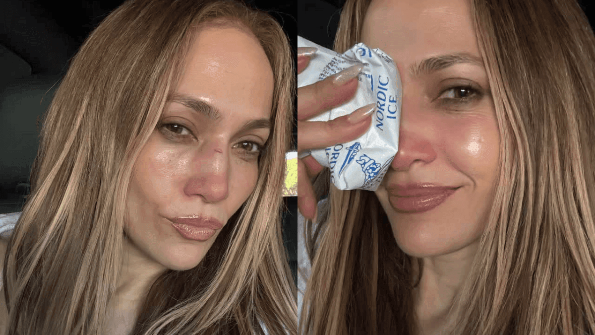 Jlo