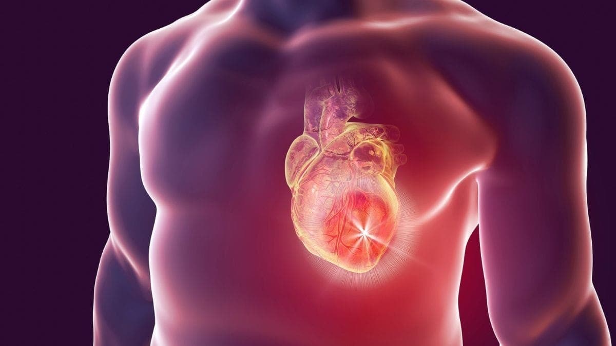 Imagem ilustrativa de doenças cardiovasculares