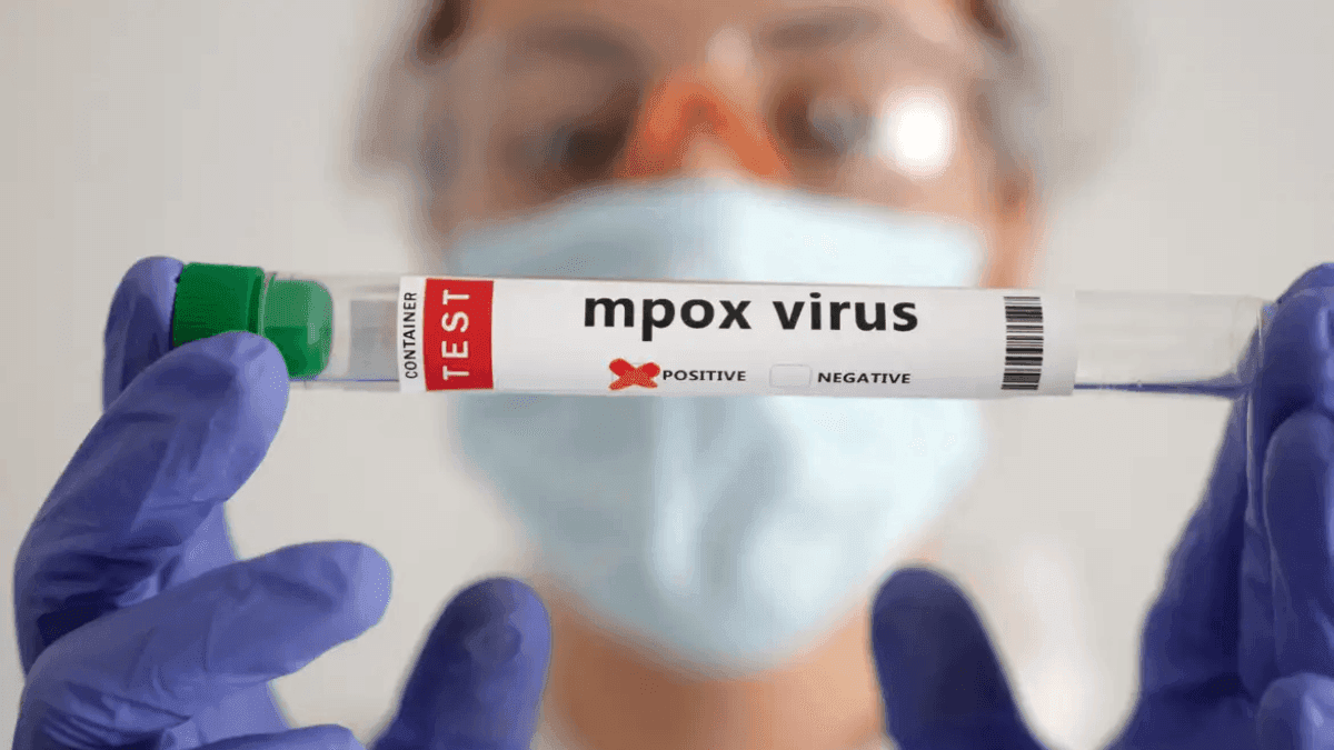 Mpox