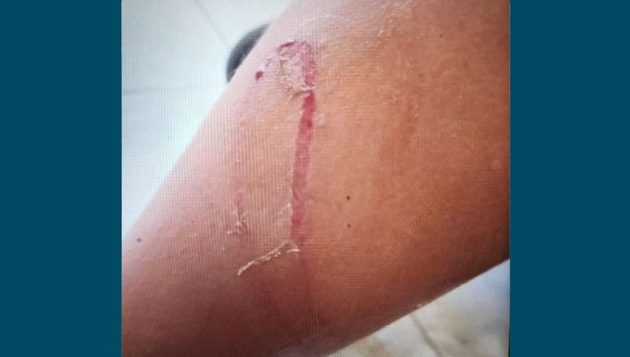 Criança ficou ferida