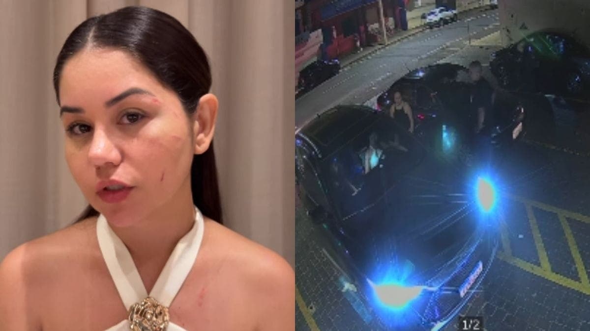 Lays Alves mostra ferimentos após agressão
