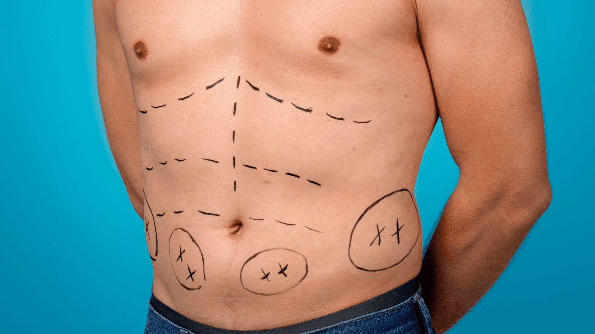 Homens procuram mais por cirurgias plásticas