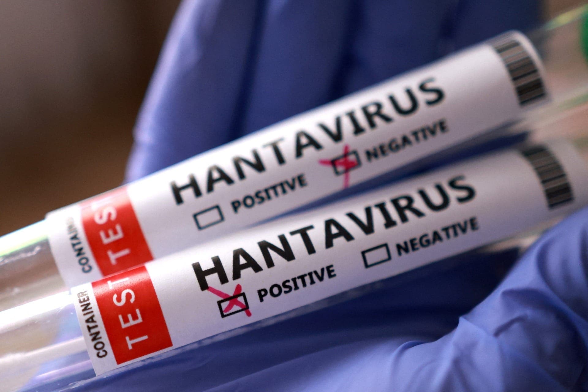 Mais dois casos de hantavírus são confirmados