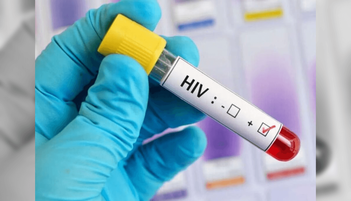 HIV