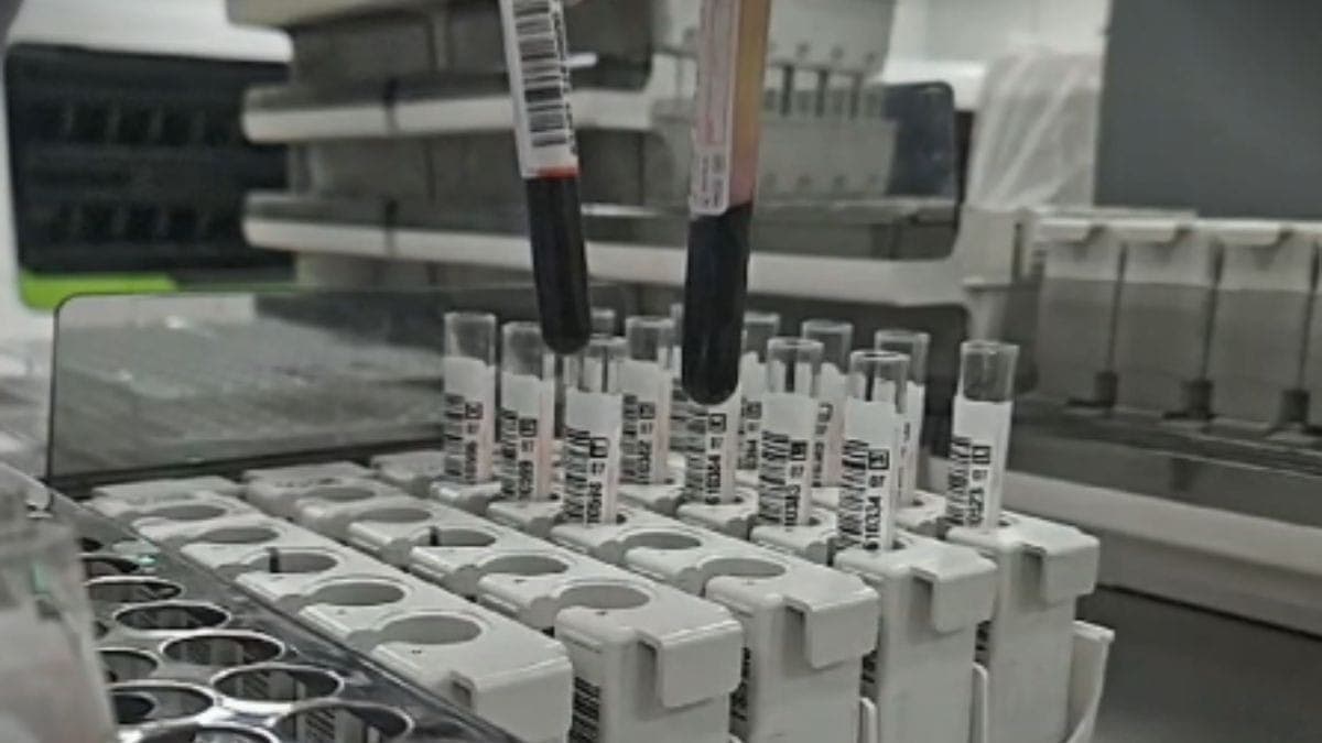 Controle de qualidade em exames de doações