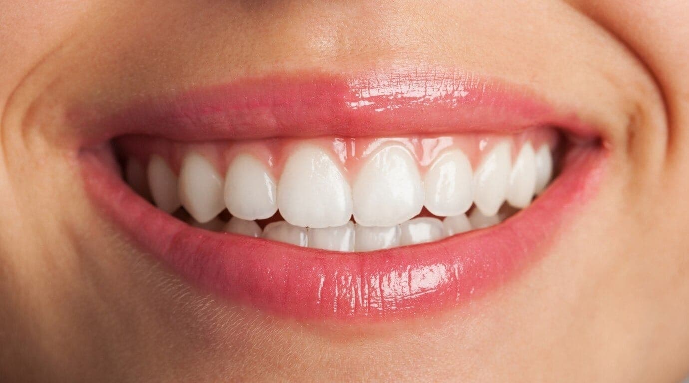 Clareamento Dental Caseiro com Whiteness Perfect