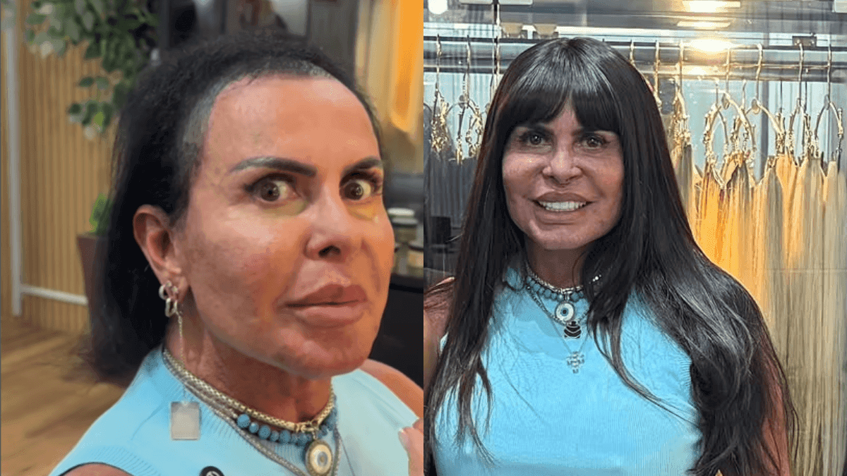 Antes e depois de Gretchen