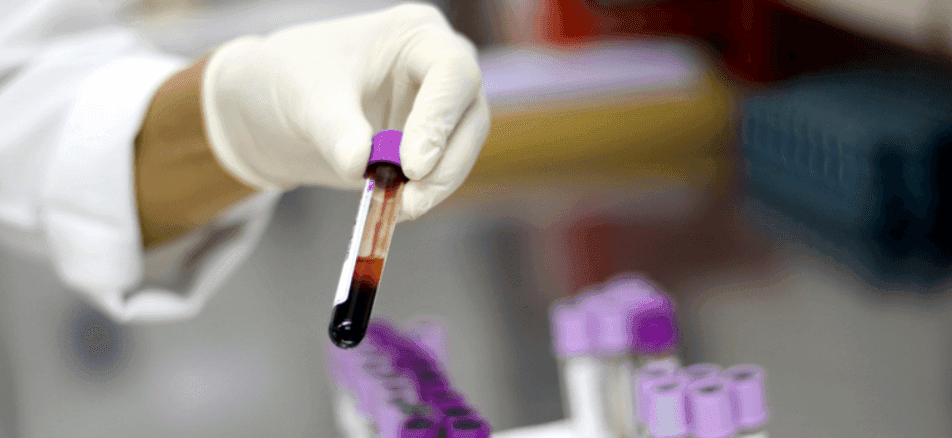 Os exames descartaram infecção da amostra por diferentes linhagens de influenza