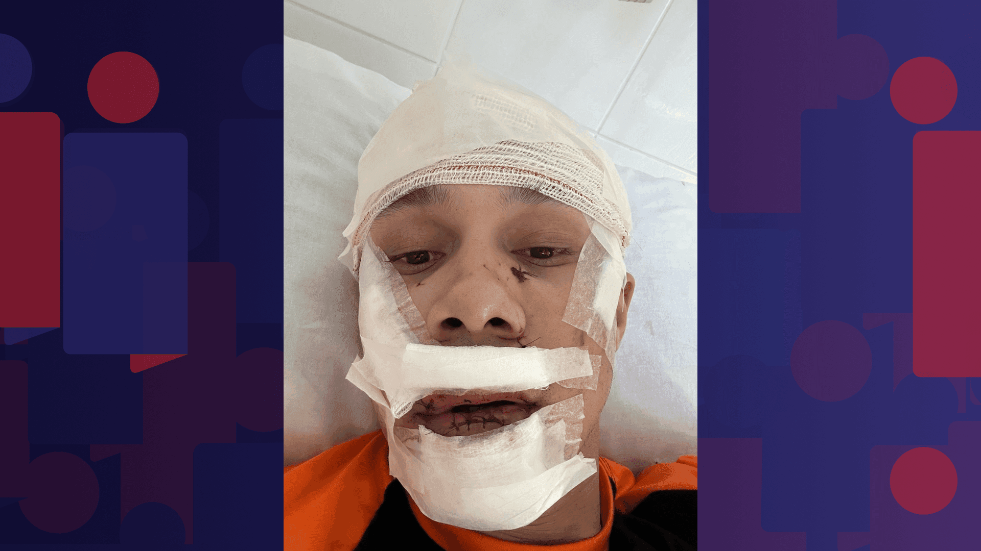 Thiago registrou o caso na Polícia Civil de São Paulo e fez o exame de corpo de delito