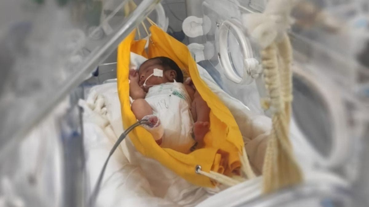 Pesquisadores do Ceará confirmam que dormir em rede ajuda prematuros