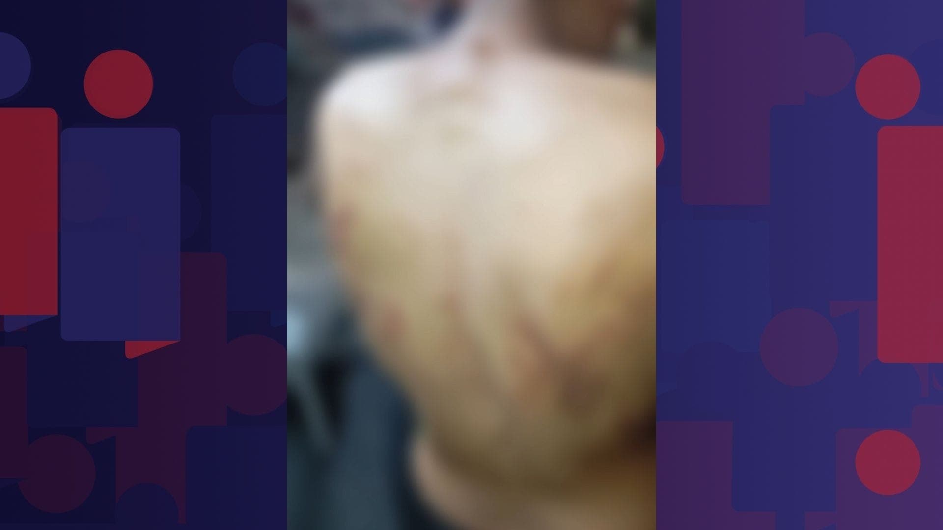 A vítima contou a reportagem que era forçado a andar de casaco até mesmo no calor para esconder as marcas no corpo
