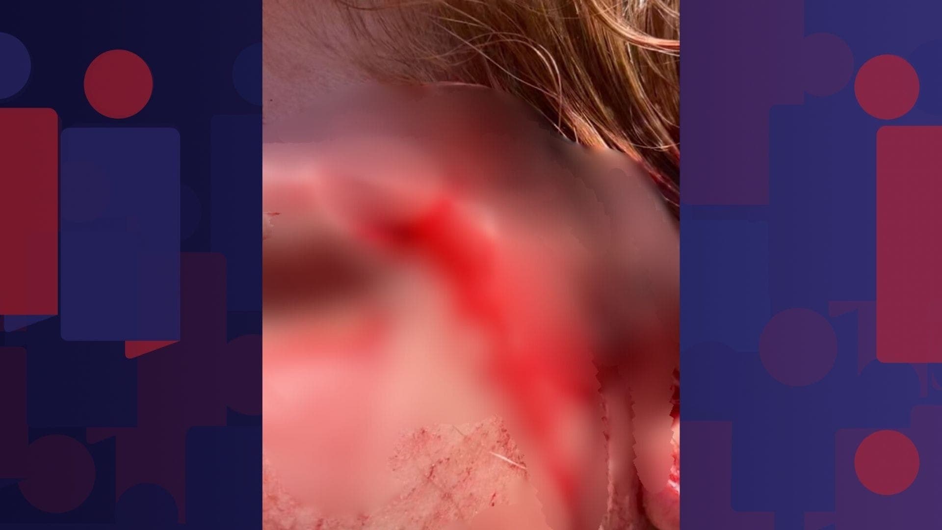 Imagens enviadas à BandNews FM mostram o rosto e cabelo de Agatha ensanguentados.