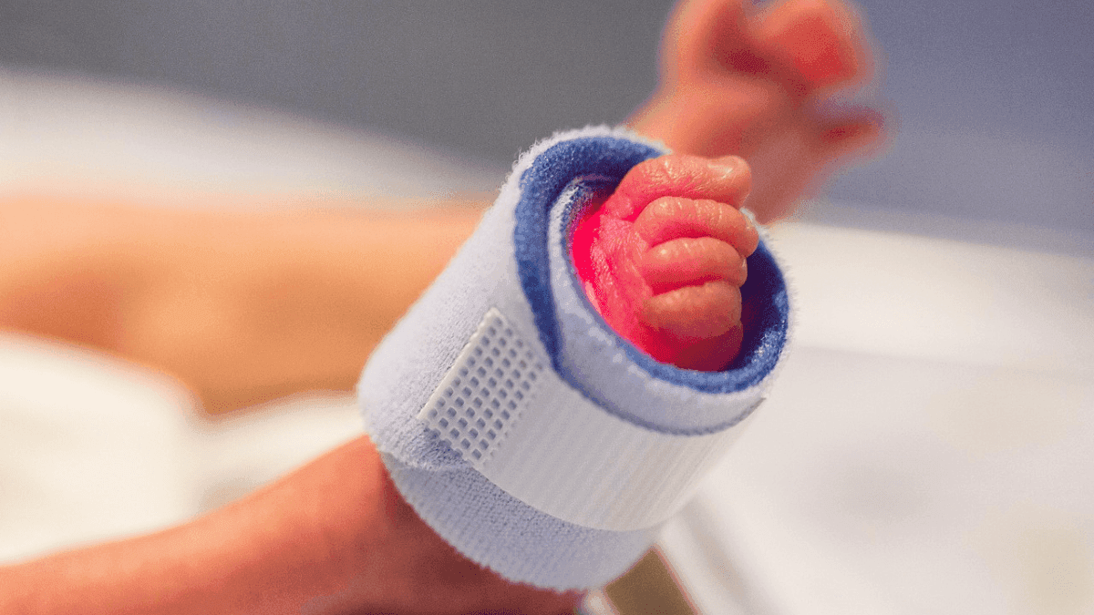 Bebê prematuro