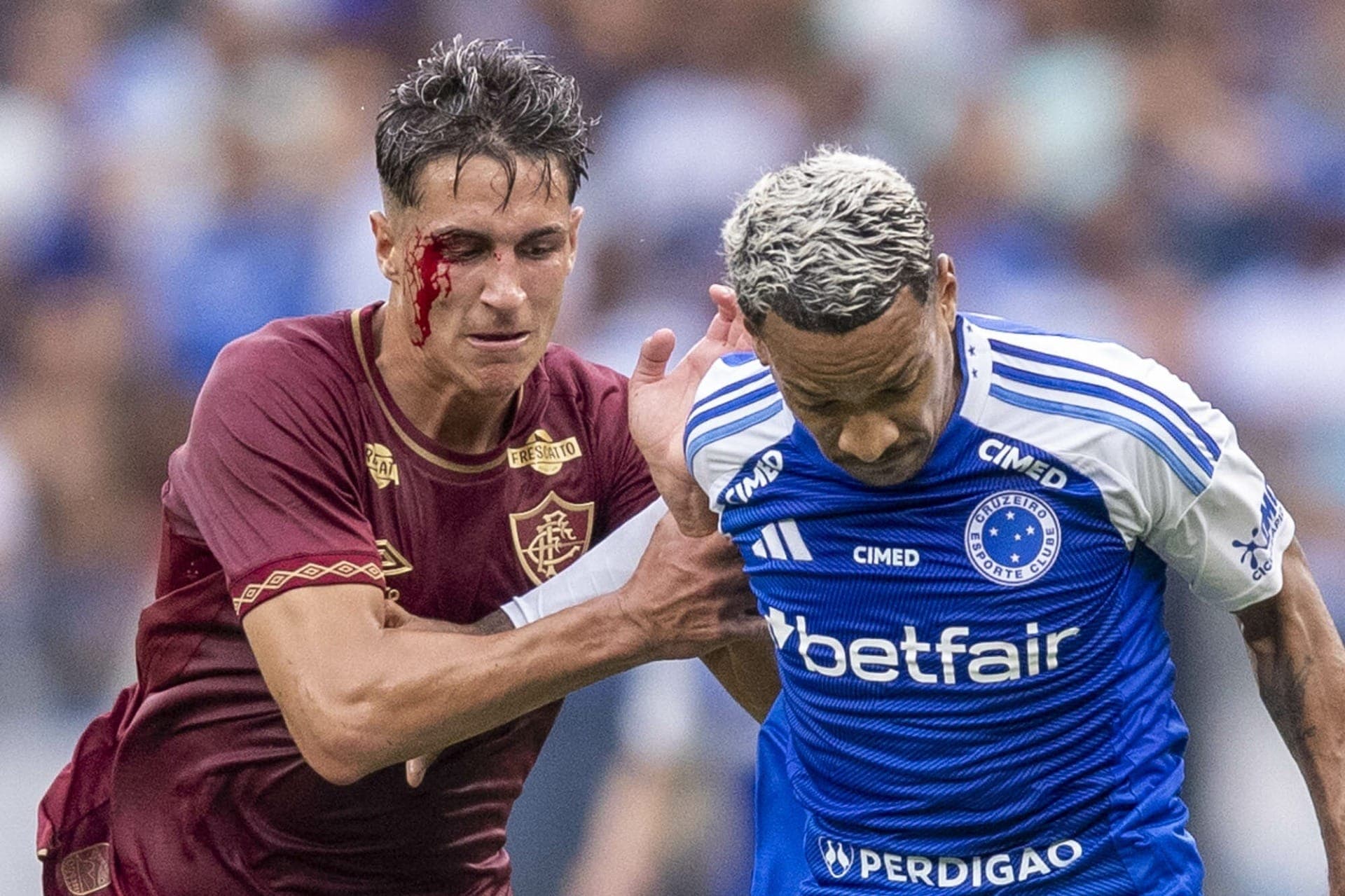 Bernal sangrando após disputa com Matheus Pereira