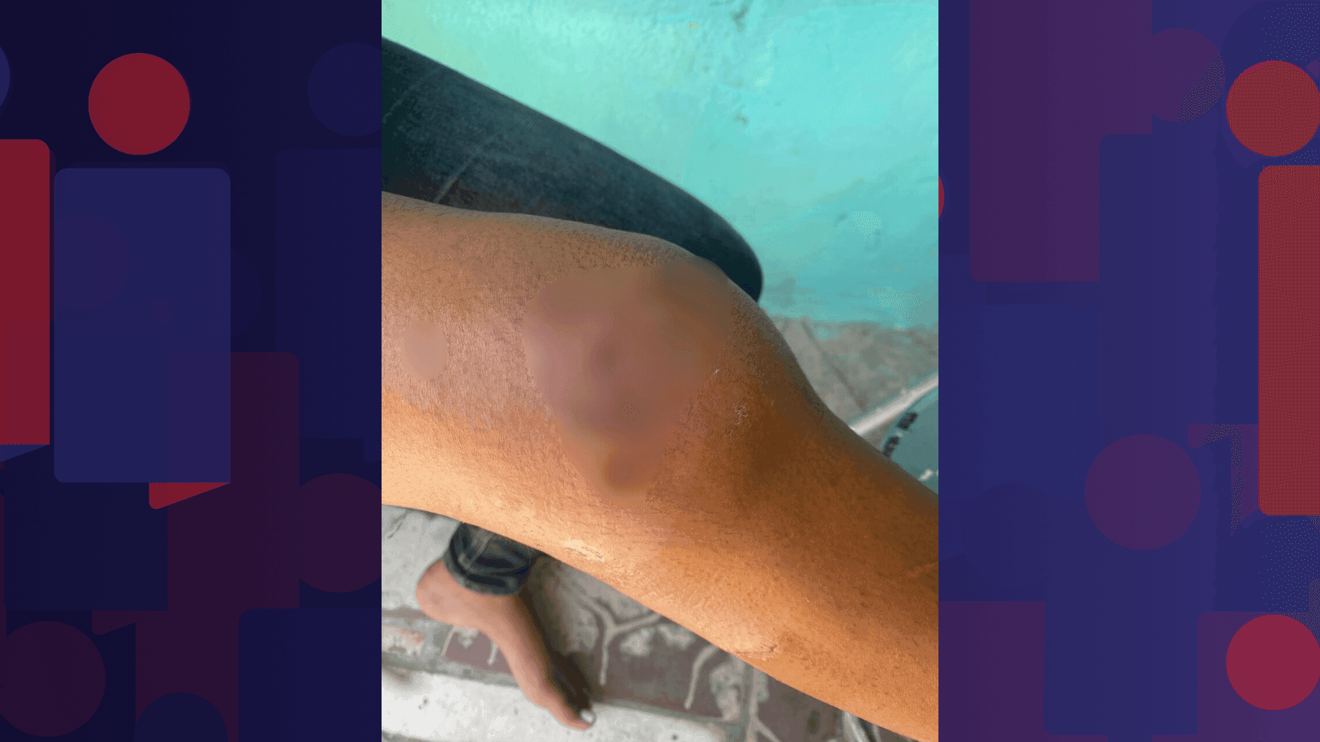 Pais de alunos e funcionários da unidade denunciam que os portões do Ciep 210 sempre ficam abertos, permitindo a entrada de animais e pessoas