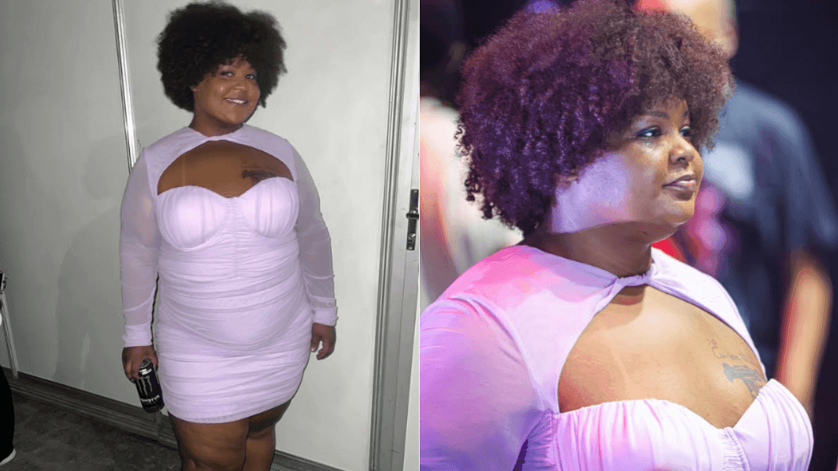 MC Carol desabafa após gastar R$ 100 mil em plásticas