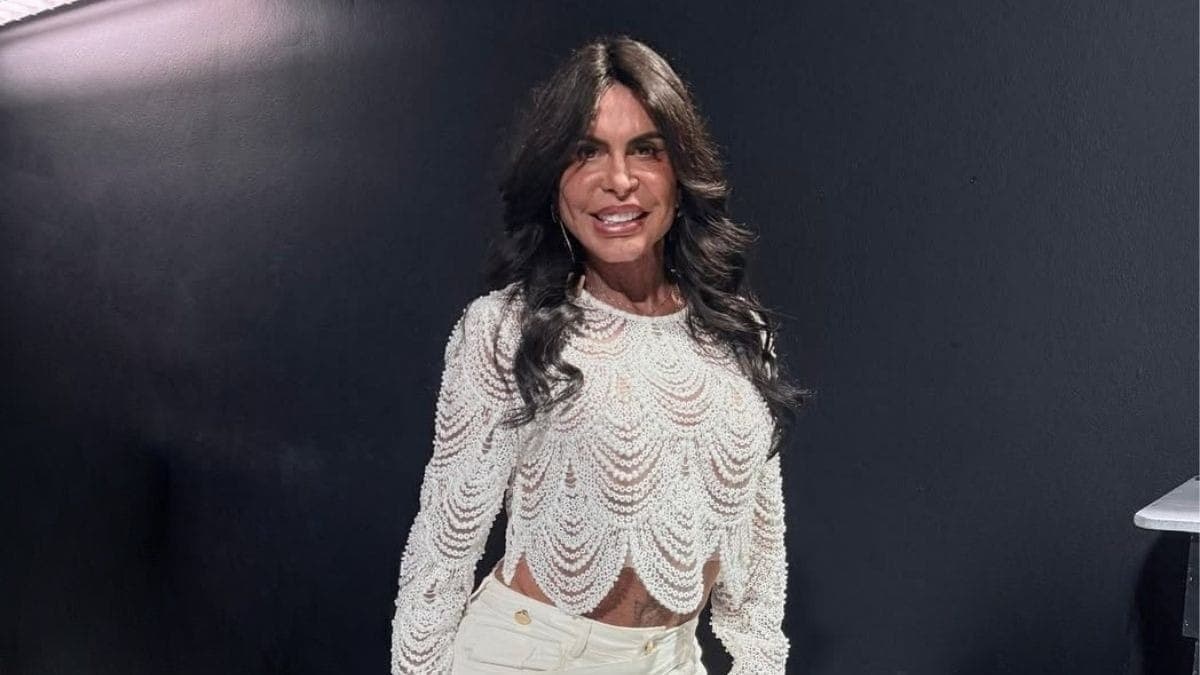 Gretchen fala sobre alopecia no Melhor da Tarde