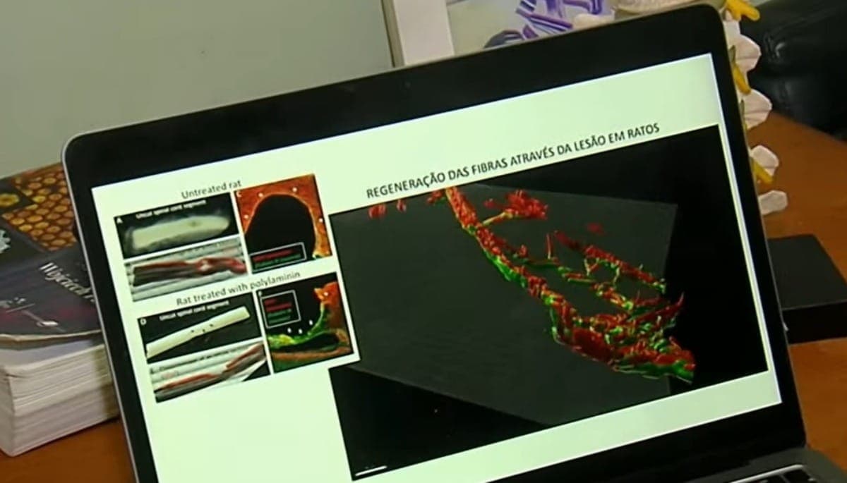 Tratamento experimental ajuda pacientes com lesão medular
