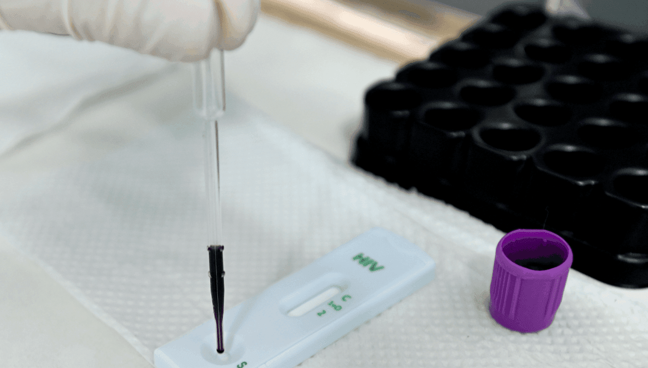 O lenacapavir é um antirretroviral que atua impedindo que o vírus HIV, causador da Aids, se multiplique no organismo