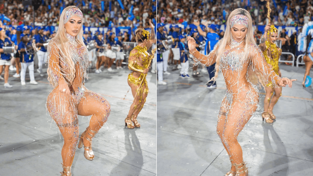 Wanessa Félix retira costela para desfilar no Carnaval