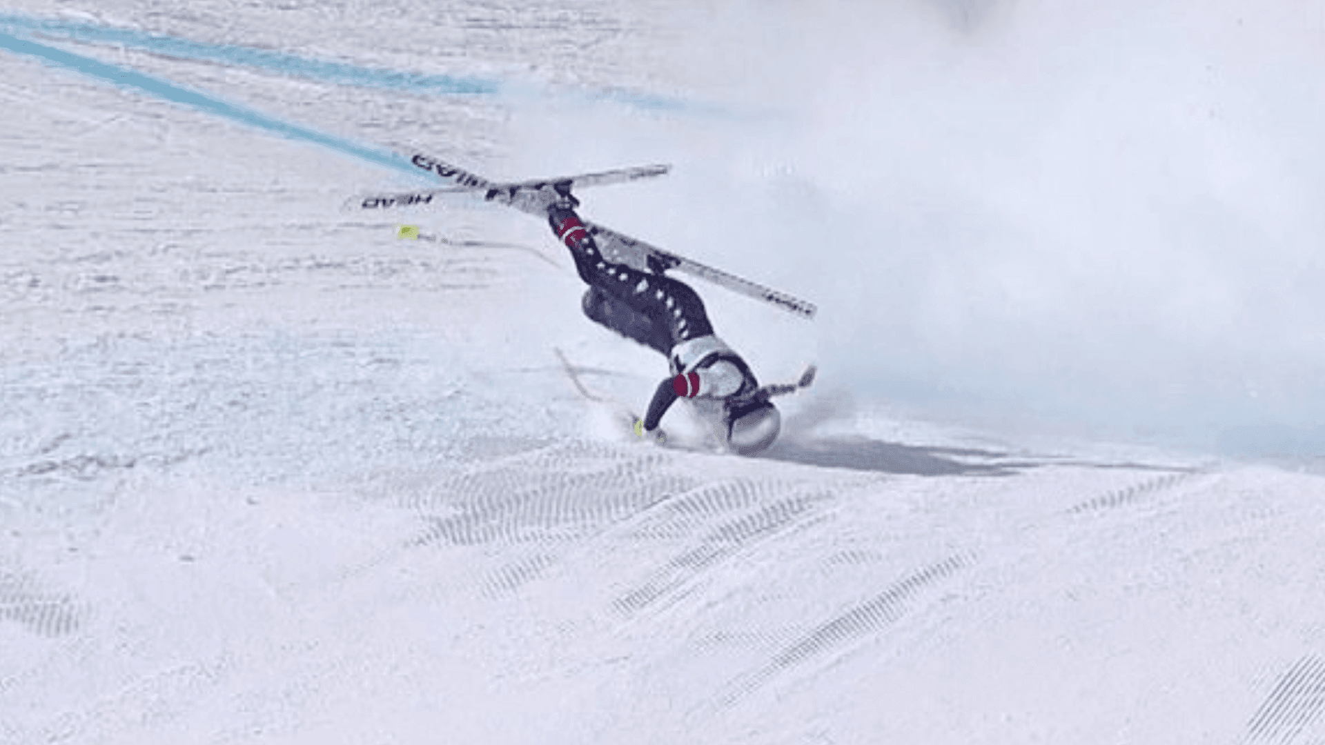 Lindsey Vonn passa por cirurgias após fratura complexa