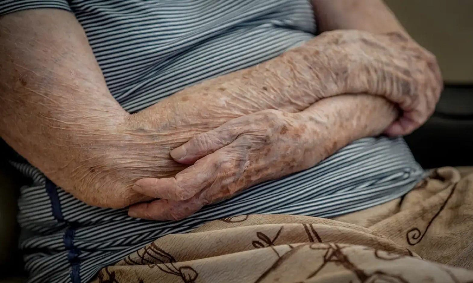 Sarcopenia é mais comum em pessoas acima dos 75 anos