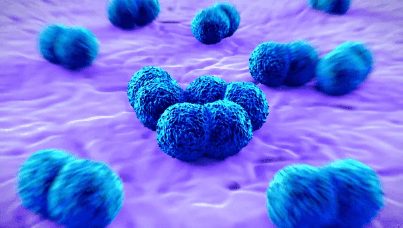Meningite bacteriana pode ser confundida com a gripe