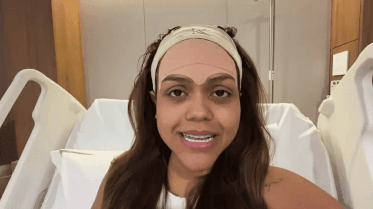 Camila Loures remove veia da testa em cirurgia