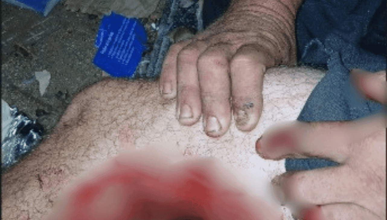 Um homem, de 38 anos, sofreu uma tentativa de homicídio na noite desta terça-feira (14)