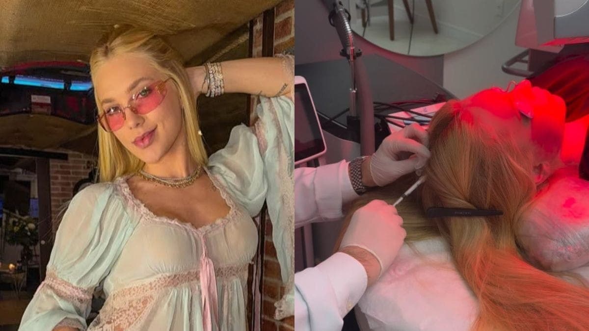 Virginia Fonseca faz tratamento contra alopecia aerata