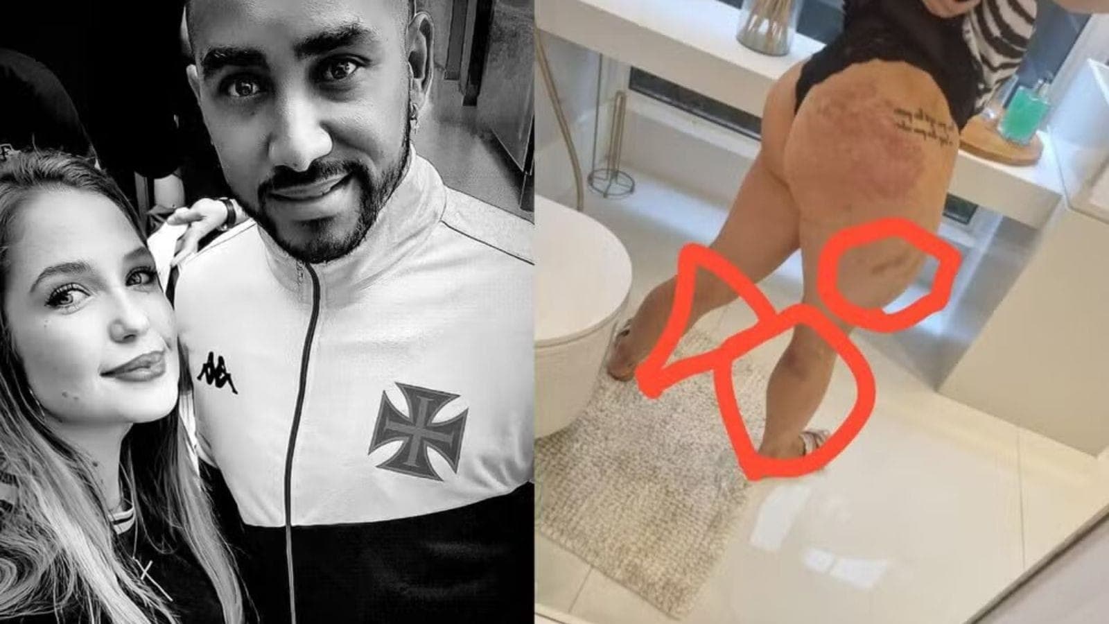 Larissa Ferrari divulgou fotos das lesões sofridas pelas agressões