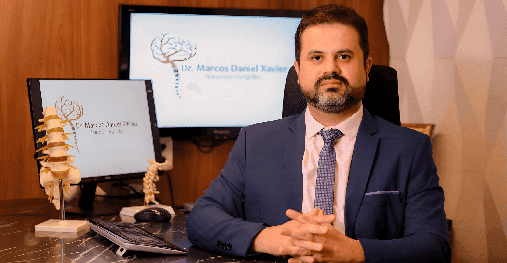 Dor de cabeça súbita: Marcos Daniel Xavier alerta para aneurisma cerebral
