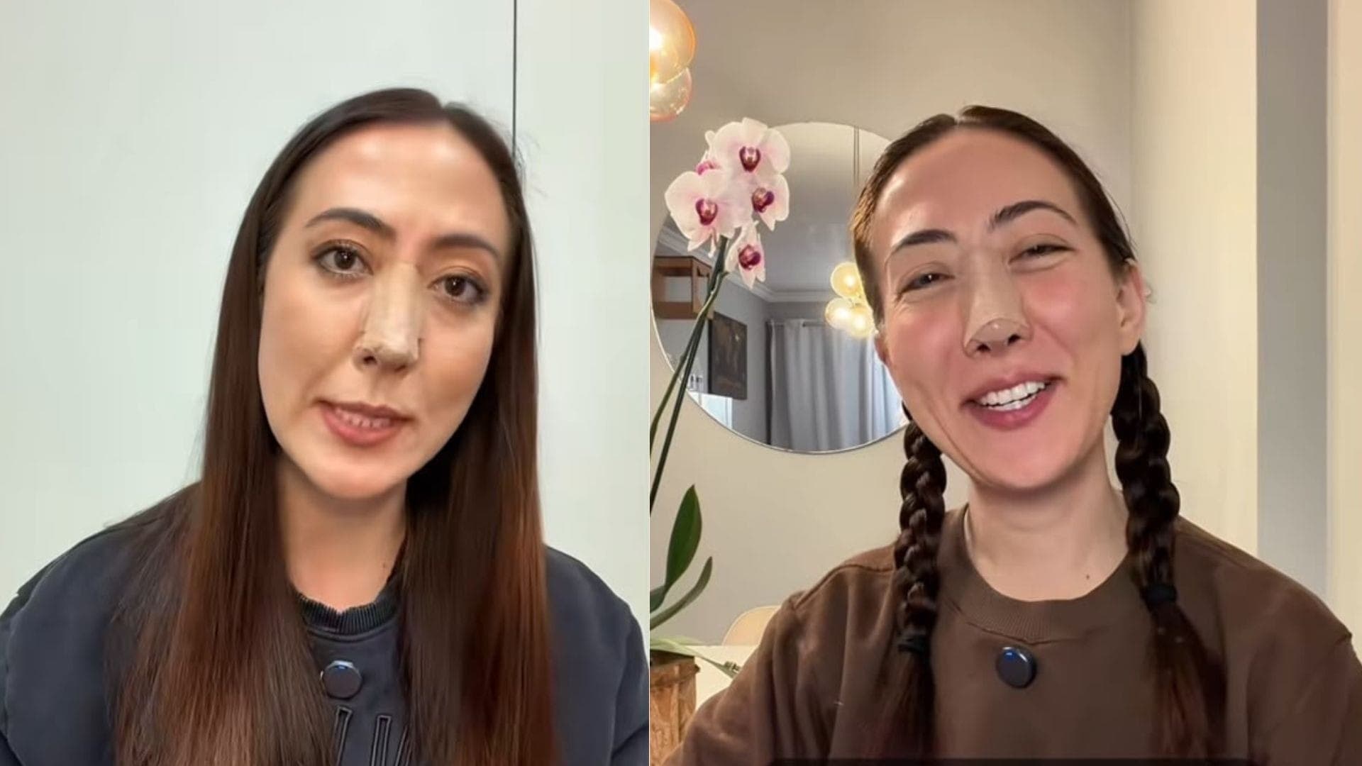 Caso da jornalista Juliane Massaoka reacendeu as discussões sobre uso do PMMA na estética