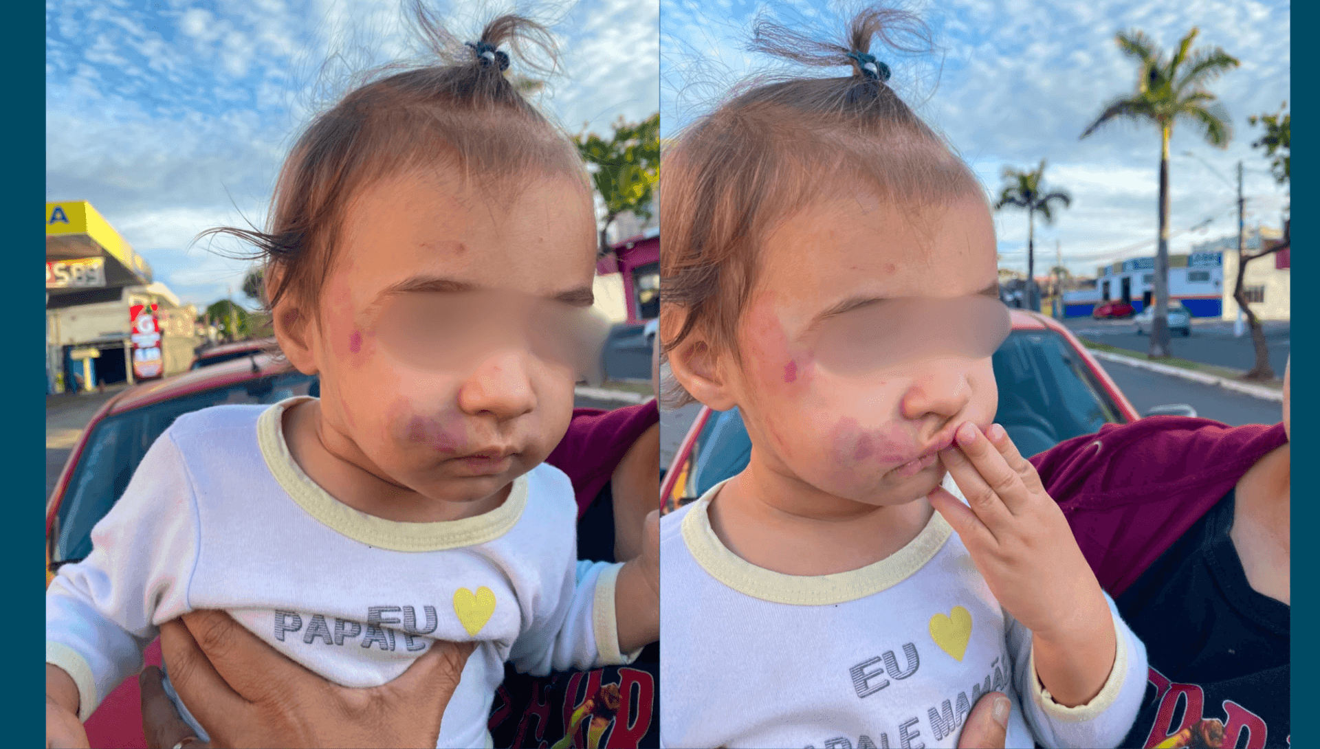 Bebê foi levada ao hospital para receber atendimento médico