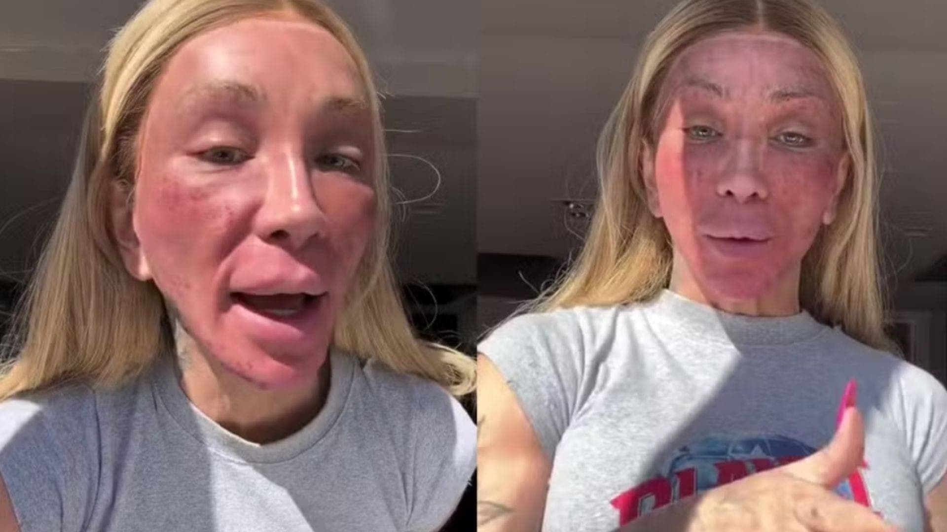 Maya Massafera fez peeling no rosto