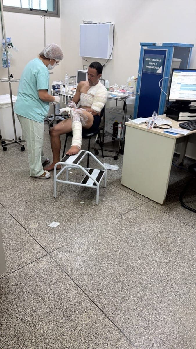 Homem também sofreu queimaduras, recebeu atendimento médico e foi encaminhado à Delegacia da Mulher