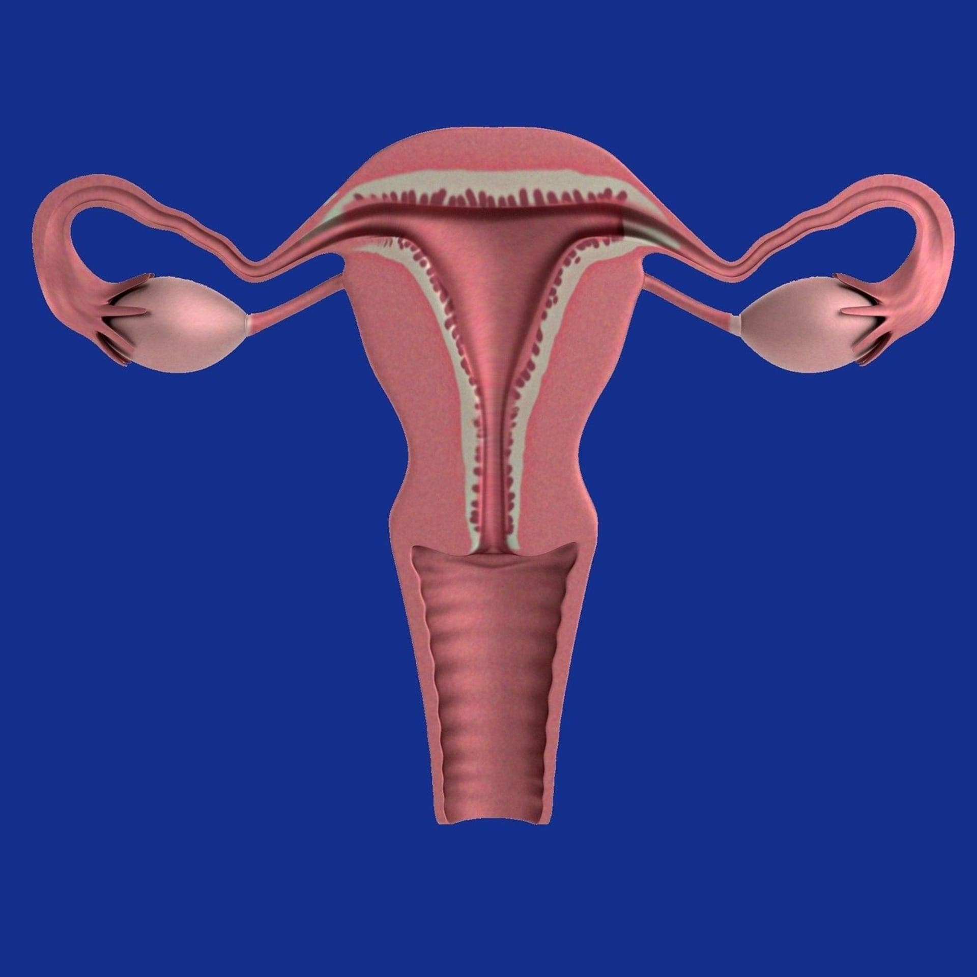 Câncer de ovário é considerado o tumor feminino mais perigoso