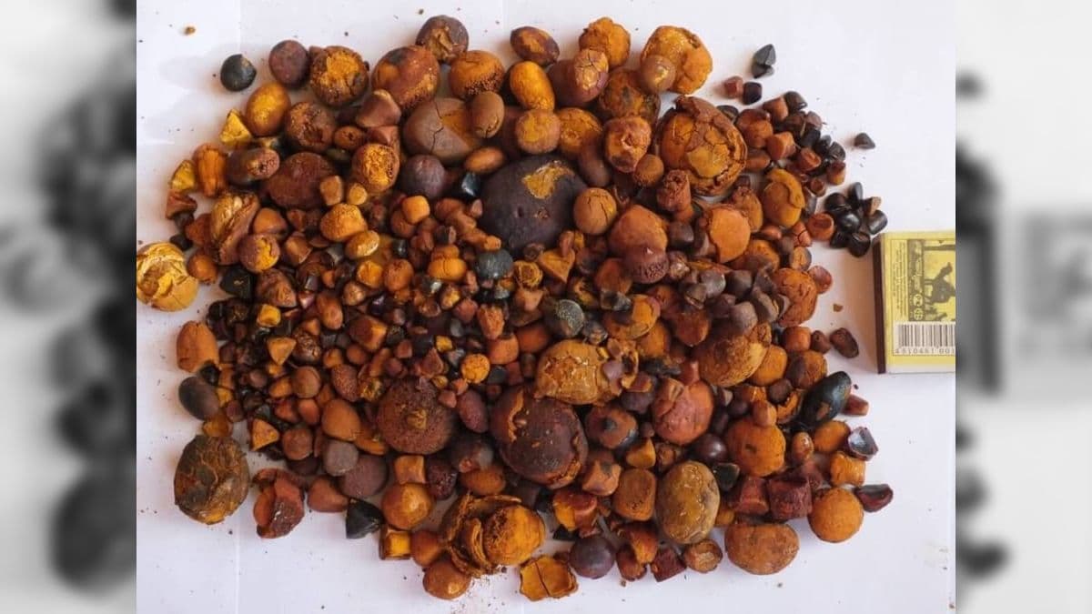 Pedras de fel são retiradas de bovinos e custam caro