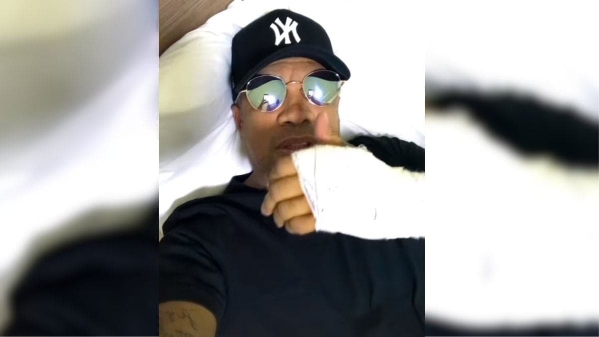 Rogerinho, percussionista do Grupo Revelação, mostra ferimento