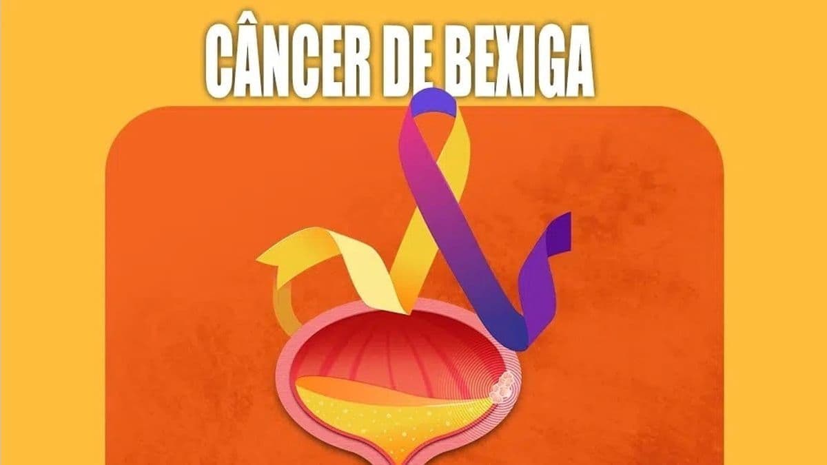 Brasil deve registrar mais de 11 mil casos de câncer de bexiga neste ano