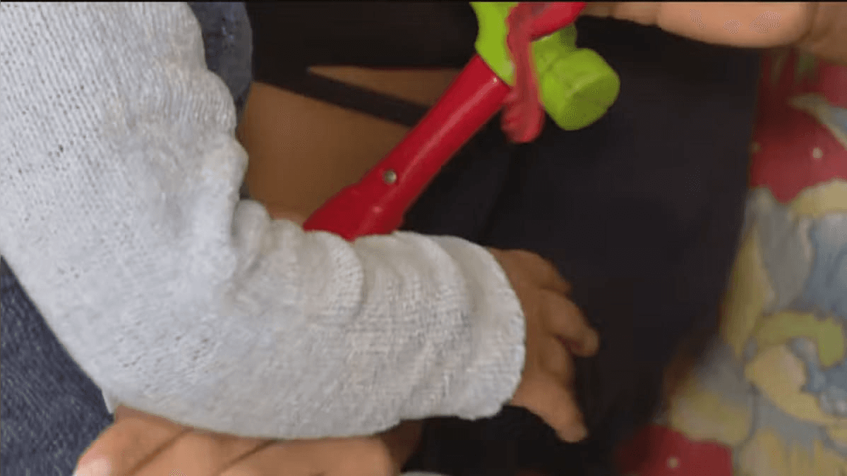 Bebê só pode passar por procedimento de correção genital após certidão ser corrigida