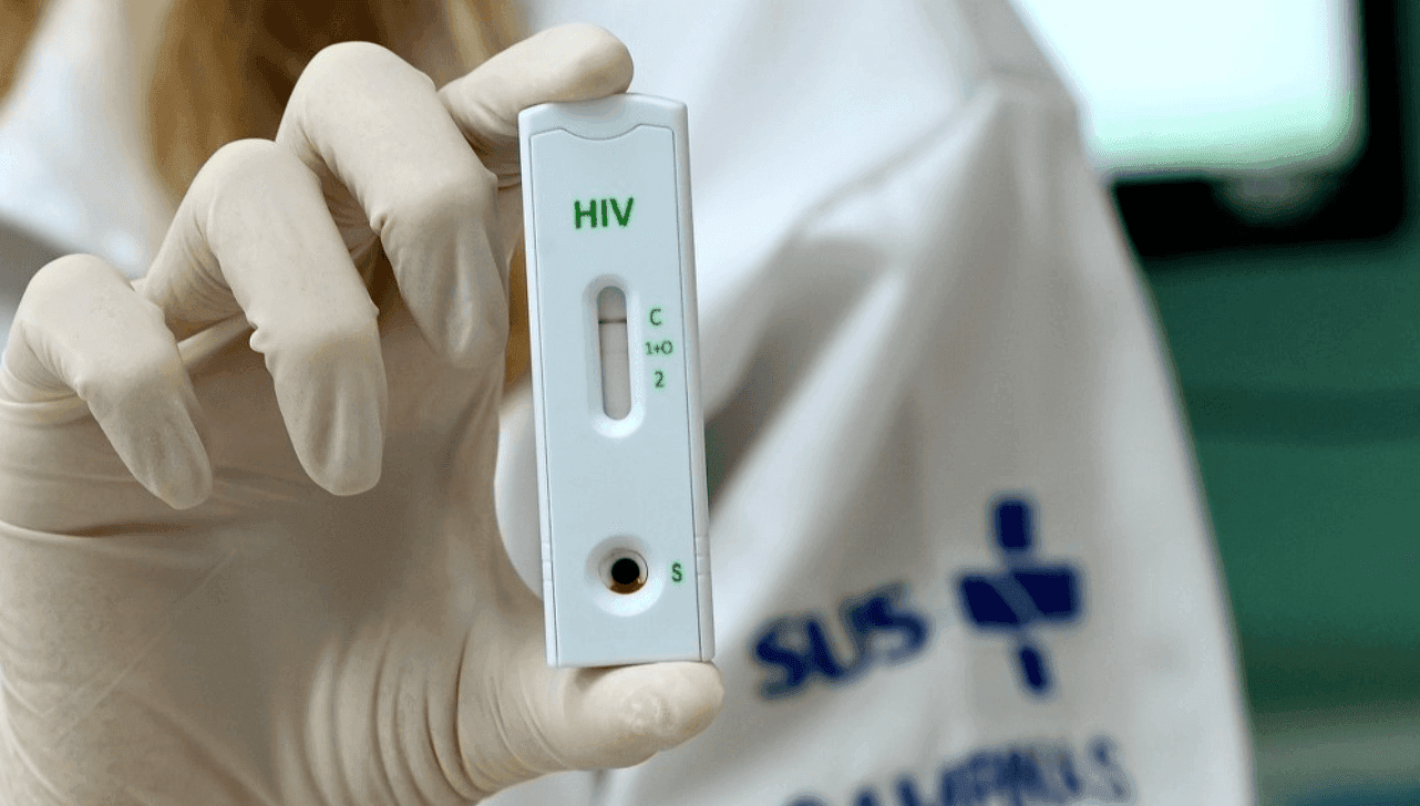 HIV