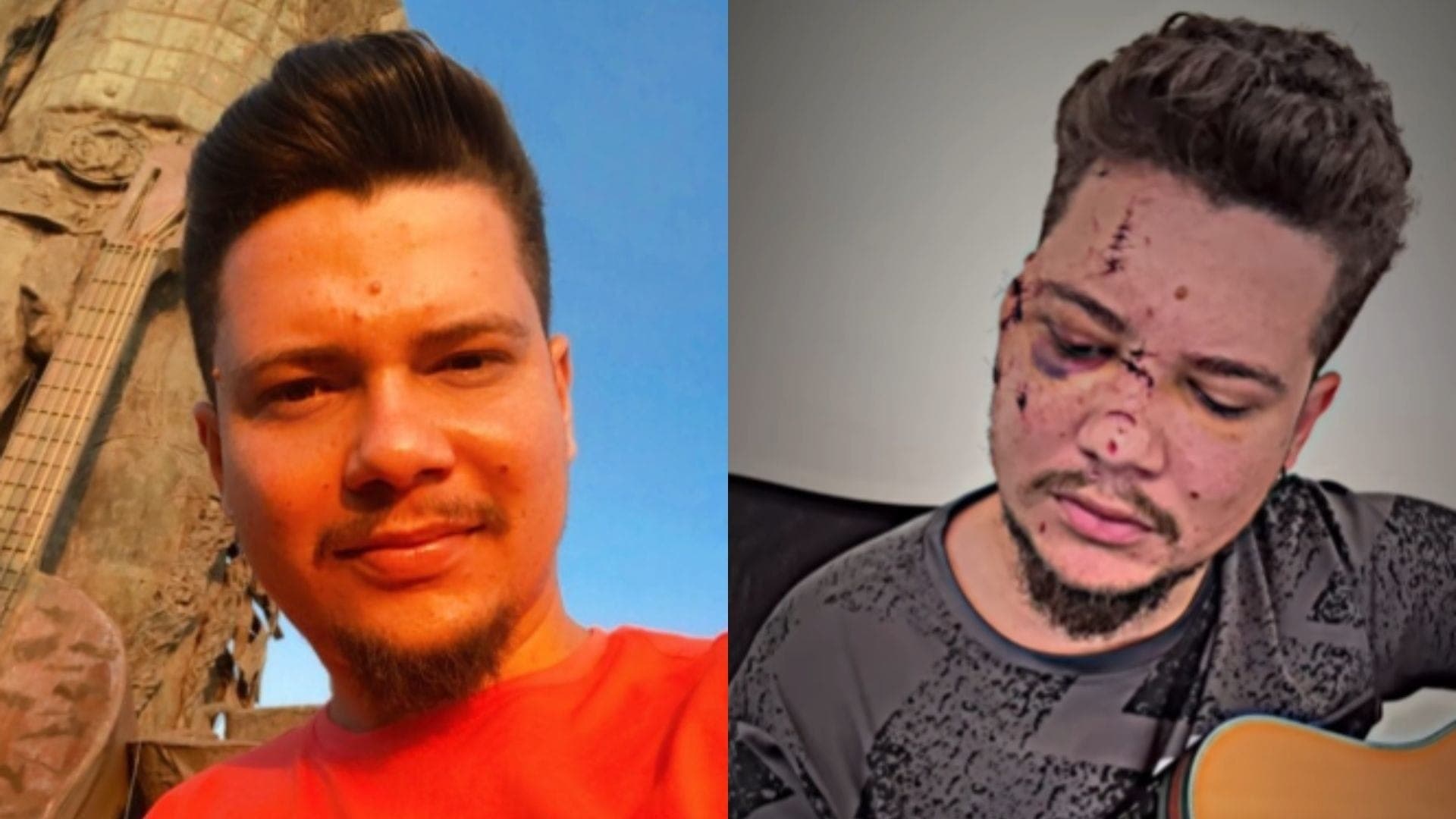 Benício foi agredido com garrafa durante festa de Réveillon