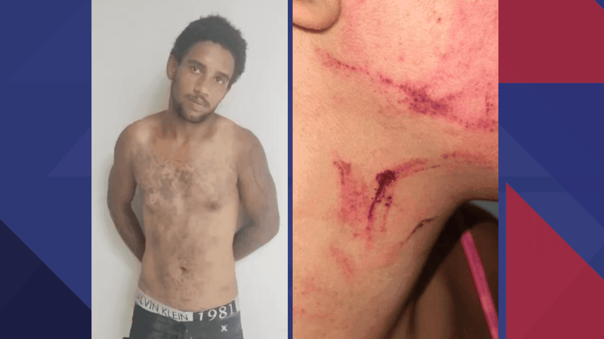Segundo o delegado responsável pelo caso, Paulo Carneiro, o criminoso tem traços de ser um assassino em série